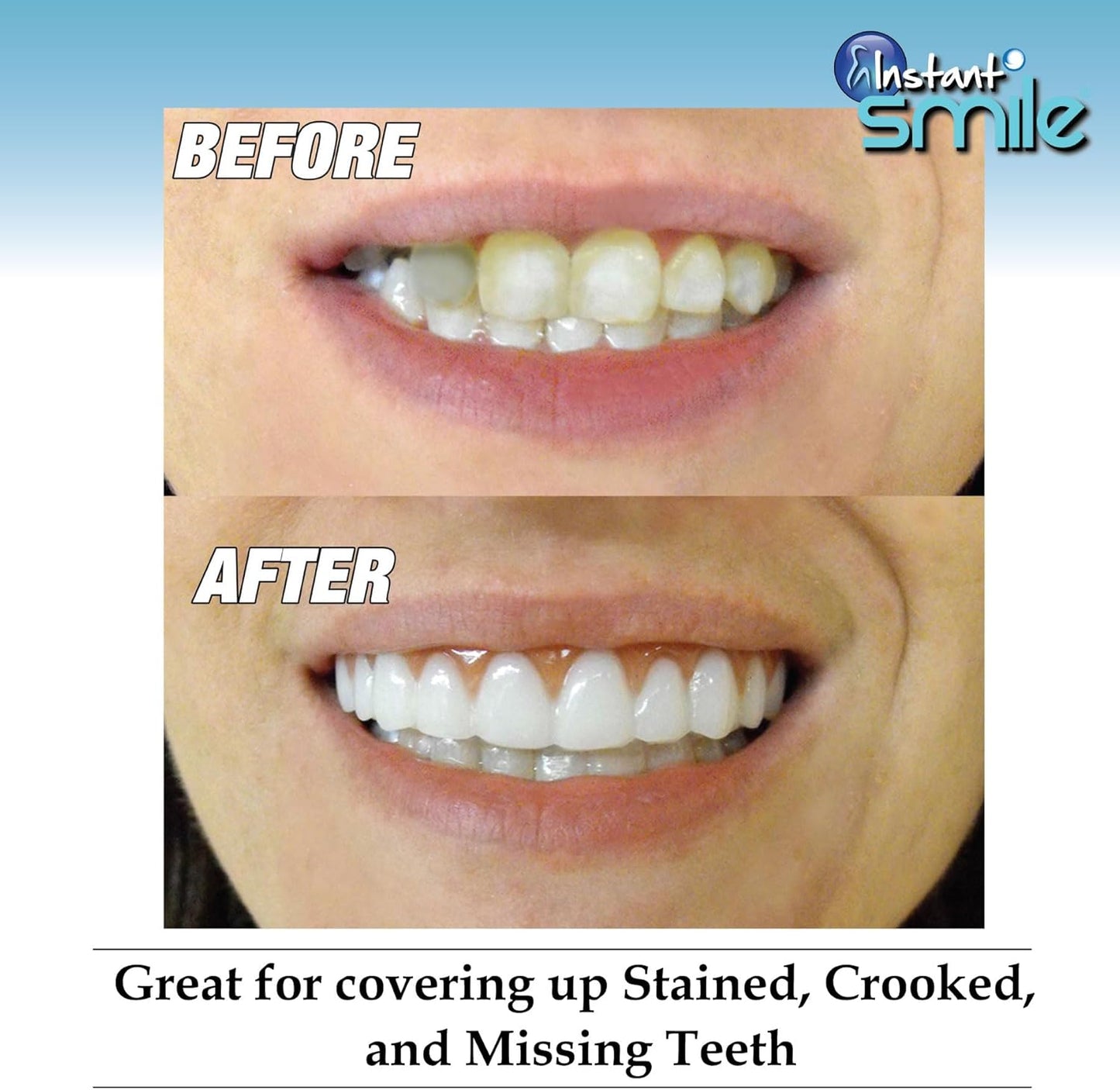 Instant Smile Comfort Fit Flex - Bright Shade - Upper Veneer Cosmetic Teeth