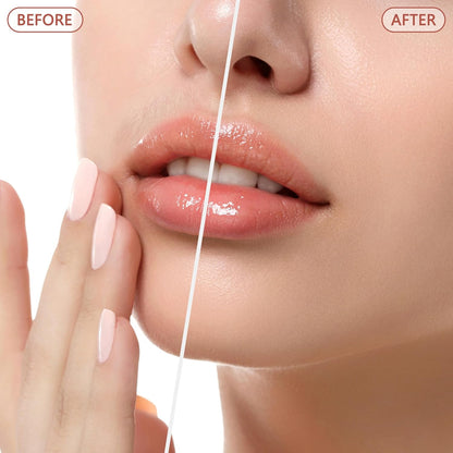 Facial Hair Remover for Women - Painless Face Shaver - Electric Hair Removal Device for Face Lips Peach Fuzz with Light