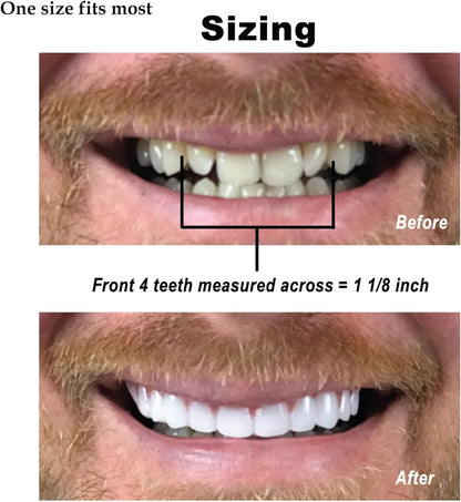 Instant Smile Comfort Fit Flex - Bright Shade - Upper Veneer Cosmetic Teeth