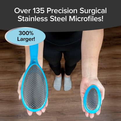 PedEgg Jumbo , Gently Removes Calluses & Dry Skin